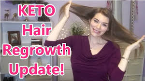 Keto Hair Loss Update And Regrowth With Pictures Allymcwowie How I Regrow My Hair Keto Hair Loss Laser Hair Loss Treatment Hair Loss Men