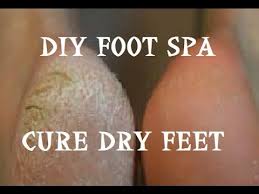 According to a recent survey by the college of podiatry, 45% of women suffer from painful cracked heels, with 10% saying 'no thanks'. Affordable Diy Foot Spa Cure Dry Damaged Feet Youtube