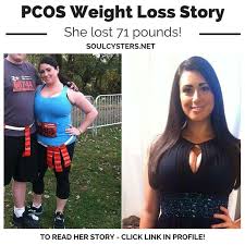 Pin On Pcos Weight Loss Stories