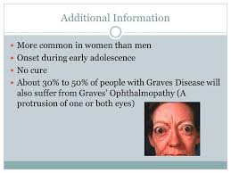 MONTANA WRIGLEY & SIERRA RYALS Graves Disease. What is Graves' Disease? An  immune system disorder that results in the production of thyroid hormones  Causes.