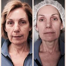 TOP 10 BEST Dermatologist Acne in Flint, MI