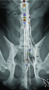 We did not find results for: Disorders Of The Cauda Equina Veterian Key