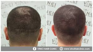 Pin On Hair Short