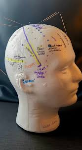 Dr Karen Lam Traditional Chinese Medicine