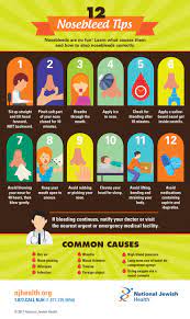 Nosebleeds Happen For A Variety Of Reasons Dry Air Allergies Infection And More Leaning Forward Works B Infographic Health Nose Bleed Homeopathic Treatment