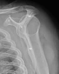 Image result for Shoulder Imaging