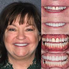 David Haley (@prolabesthetics) • Instagram photos and videos