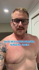 GYNECOMASTIA SURGERY & BEYOND BY JONATHAN LEBOWITZ MD, LEBOWITZ PLASTIC  SURGERY, LONG ISLAND GYNECOMASTIA CENTER HUNTINGTON #gyno  #maleplasticsurgey #gynecomastia #plasticsurgery #plasticsurgeon  #cosmeticsurgery #male #liposuction #surgery #lipo ...