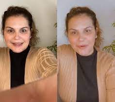 Katia aveiro antes e depois. Acha Que E Botox Nao Katia Aveiro Engana Se E Mostra Se Sem Filtro Ao Natural Celebridades Flash