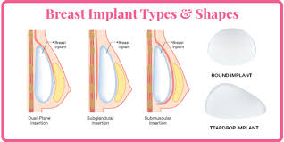 Most insurance companies do cover breast reduction surgery if prior approval is. Aesthetic Breast Procedures Healthywomen