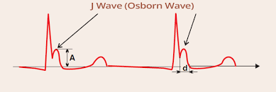 Image result for J Wave