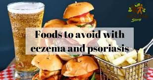 Foods To Avoid With Eczema And Psoriasis Foods To Avoid Food Eczema Foods To Avoid