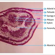 Image result for Isoberlinia doka