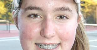 Sister sets hold key for Wando High School's tennis title hopes