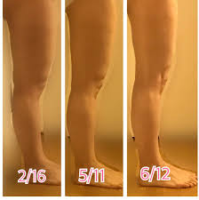 太い前もものハリに1ヶ月で効果があった2つの方法 モカログダイエット むくみをとる ダンベル ももは