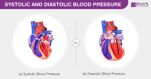 High blood pressure often does not cause any signs of illness that you can see or feel. Blood Pressure Types Of Blood Pressure And Its Differences