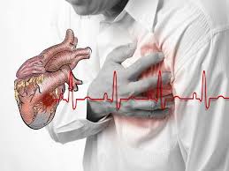 1950, in the meaning defined above. à®• à®° à®Ÿ à®¯ à®• à®…à®°à®¸ à®Ÿ à®à®± à®ªà®Ÿ à®µà®¤à®± à®• à®® à®© à®© à®² à®¤ à®° à®¯ à®® à®…à®± à®• à®± à®•à®³ Symptoms For Cardiac Arrest Tamil Boldsky