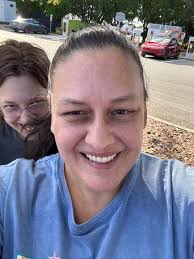 Waiting for upper denture after teeth extraction