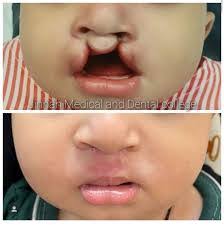 Chad Endres's Instagram, Twitter & Facebook