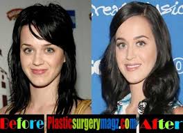 Katy Perry Nose Job Katy Perry Plastic Surgery Before And After