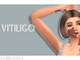 The mods folder is found in documents > electronic arts > the sims 4 > mod. Thesimgirl011 S Chibi Xian Vitiligo