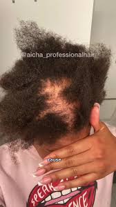 It's Alopecia Saturday y'all🥳 I'm excited to share @Drea Knowsbest’s story  with you in this video. Hair loss has no age but hair loss should never  stop your slay And we offer amazing transformations💫 ...