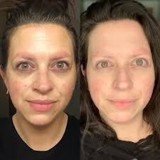 Hair growth and skin health improvement in 2 years