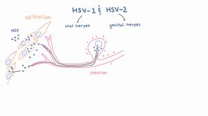 Symptoms of herpes simplex virus type 1. Hsv 1 And 2 Pathogenesis Of Oral And Genital Herpes Youtube