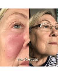 Eco by Sonya Glory Oil