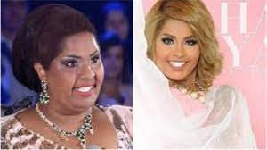 نصائح قبل القيام بعمليات التجميل. Ø´Ø§Ù‡Ø¯ÙˆØ§ Ø§Ù„ØªØºÙŠÙŠØ±Ø§Øª Ø§Ù„Ø¬Ø°Ø±ÙŠØ© Ù„Ù†Ø¬Ù…Ø§Øª Ø§Ù„Ø®Ù„ÙŠØ¬ Ø¨Ø¹Ø¯ Ø¹Ù…Ù„ÙŠØ§Øª Ø§Ù„ØªØ¬Ù…ÙŠÙ„ Ø¨Ø§Ù„ØµÙˆØ±