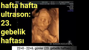 Haftamdayim yarın randevum var acaba bebislerinizin boyu ve kilosu nedir. 23 Gebelik Haftasinda Anne Karnindaki Bebek Aciklamali Detayli Ultrason Ve Renkli Doppler Youtube