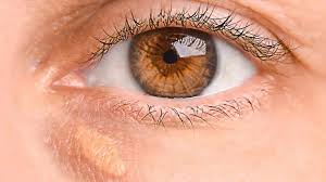 Image result for xantelasma