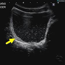 Pin On Abdomen Pelvis
