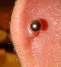 Pin On Body Piercing Infection