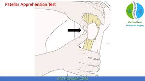 Image result for Patella Mobility Test