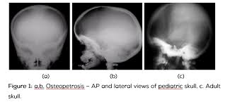 Image result for Skull XRay