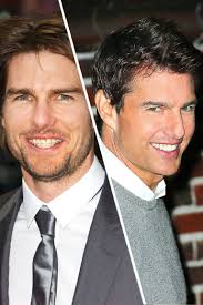 We did not find results for: Famous Faces With Braces Faith Hill And More Celebrities Who Had Braces