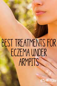 While Eczema Can Appear Anywhere On The Body A Prime Spot For Irritation Is In The Folds Of The Body Such As Armpit Rash Rash Treatment How To Treat Eczema