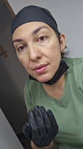 Vamos a empezar un fibroblast, ¿Ya conoces el tratamiento 😍?