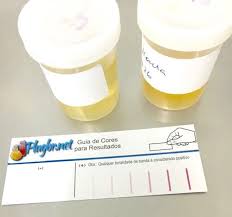 Alguns indicam que a paciente urine diretamente sobre a fita, outros contem um recipiente em que deve ser coletada a urina, para a fita. Teste De Gravidez Quando Realizar O Exame Precisao Do Resultado E Valor Do Kit De Farmacia Plugbr Net