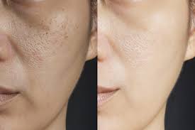 Siti Med Spa | San Diego Anti-Aging Treatments