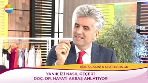 Yanik Izi Nasil Gecer Youtube