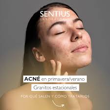 Sabías que los granitos también llegan con los cambios de estaciones  cálidas? 🌸 La primavera y veranos traen consigo más calor y humedad, lo  que puede hacer que la piel se vea