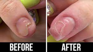 Nondominanthandapplication Youtube Remove Acrylic Nails Acrylic Nail Shapes Cotton Candy Nails