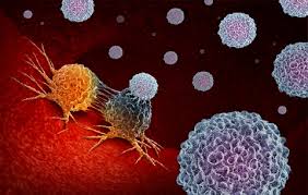 Check spelling or type a new query. Mesothelioma Immunotherapy Treatment With Immunotoxin