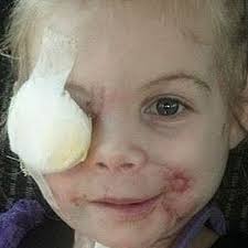 Family of girl attacked by dogs won't take KFC money