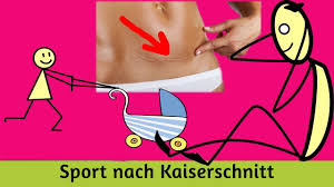 Etwa sechs bis acht wochen nach der geburt können sie mit einem rückbildungskurs beginnen. Sport Nach Kaiserschnitt Youtube