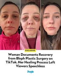 Authorities in New York State arrested a 53-year-old woman after recovering  the body of her sister from a river several days after the victim  disappeared. Penny Busch, 62, was found dead in