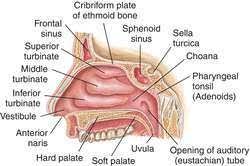 Nasal Cavity Definition Of Nasal Cavity By Medical Dictionary Sinus Infection Sinusitis Nasal Cavity