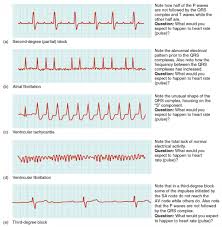 cardiac muscle and electrical activity anatomy and